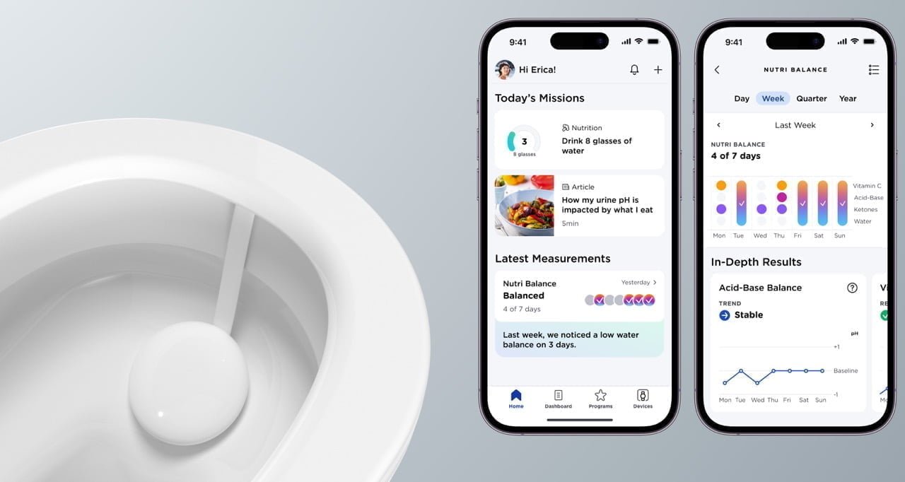 Withings-u-scan