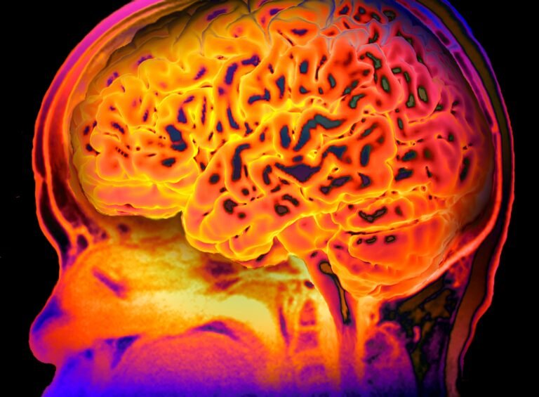 Yeni Çalışma, ADHD’nin 3 Farklı Türü Olabileceğini Öne Sürüyor