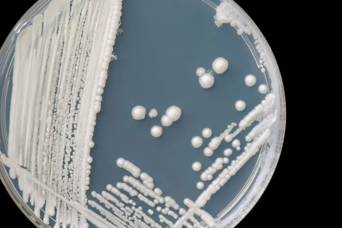 Candida auris Ciltte Nasıl Saklanıyor? Bilim İnsanları Mekanizmayı Ortaya Çıkardı Candida auris Ciltte Nasıl Saklanıyor? Bilim İnsanları Mekanizmayı Ortaya Çıkardı
