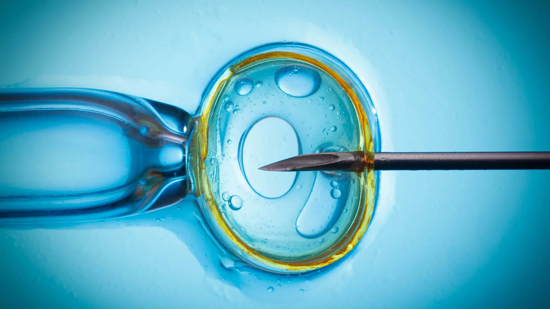 IVF
