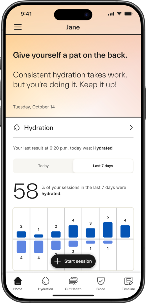 Akıllı tuvaletin öncüsü olan Kohler'in Dekodasını her kullandığınızda, akıllı kamera sayesinde Kohler Health uygulaması kişiselleştirilmiş profilinize yeni veriler ekleyerek zaman içindeki sonuçlarınızın tam bir resmini oluşturuyor.